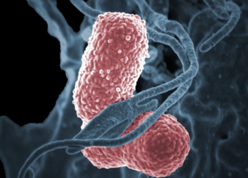 Brote de bacteria Klebsiella está confinado en Edomex; no hay señales en otras entidades: académica de la UNAM