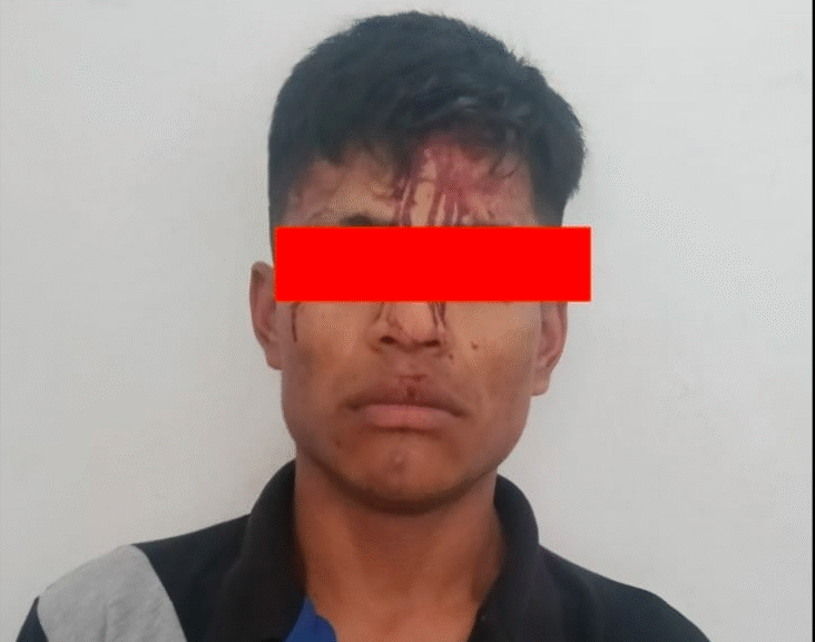 Hombre que protagonizó ataque armado en Zacatelco escapa de la SSC; sigue prófugo