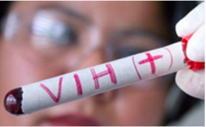 Al alza, epidemia de VIH/sida, con 18 mil casos nuevos al año